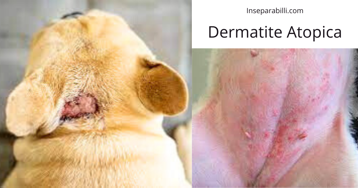 Dermatite Atopica